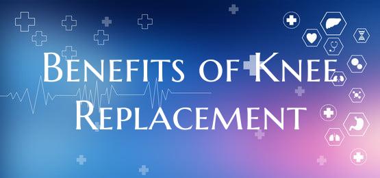 Benefits of Knee Replacement