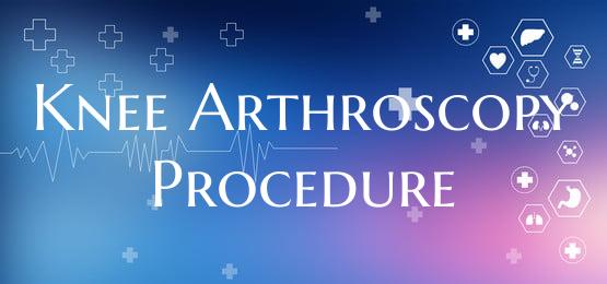 Knee Arthroscopy Procedure