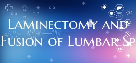 Laminectomy and Fusion of Lumbar Sp