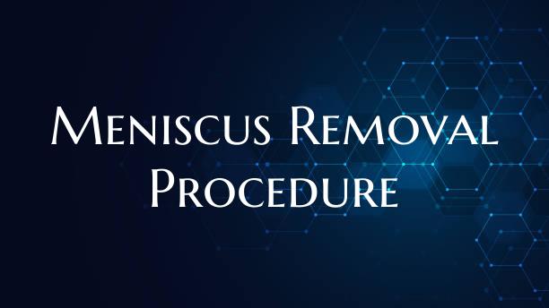 Meniscus Removal Procedure