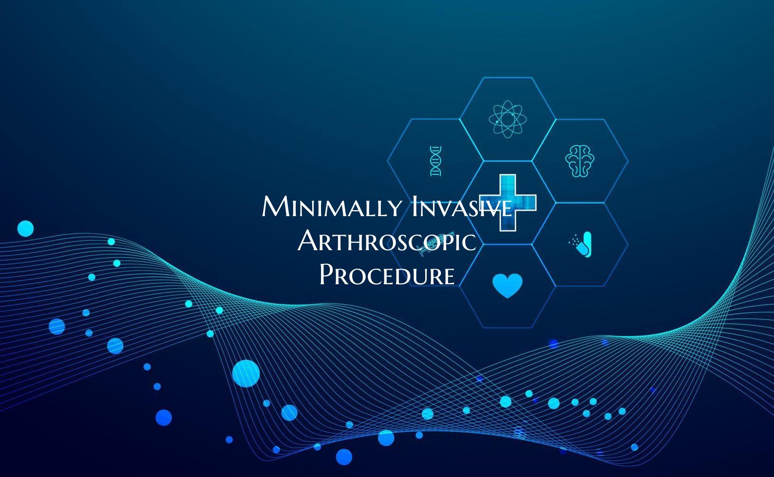 Minimally Invasive Arthroscopic Procedure