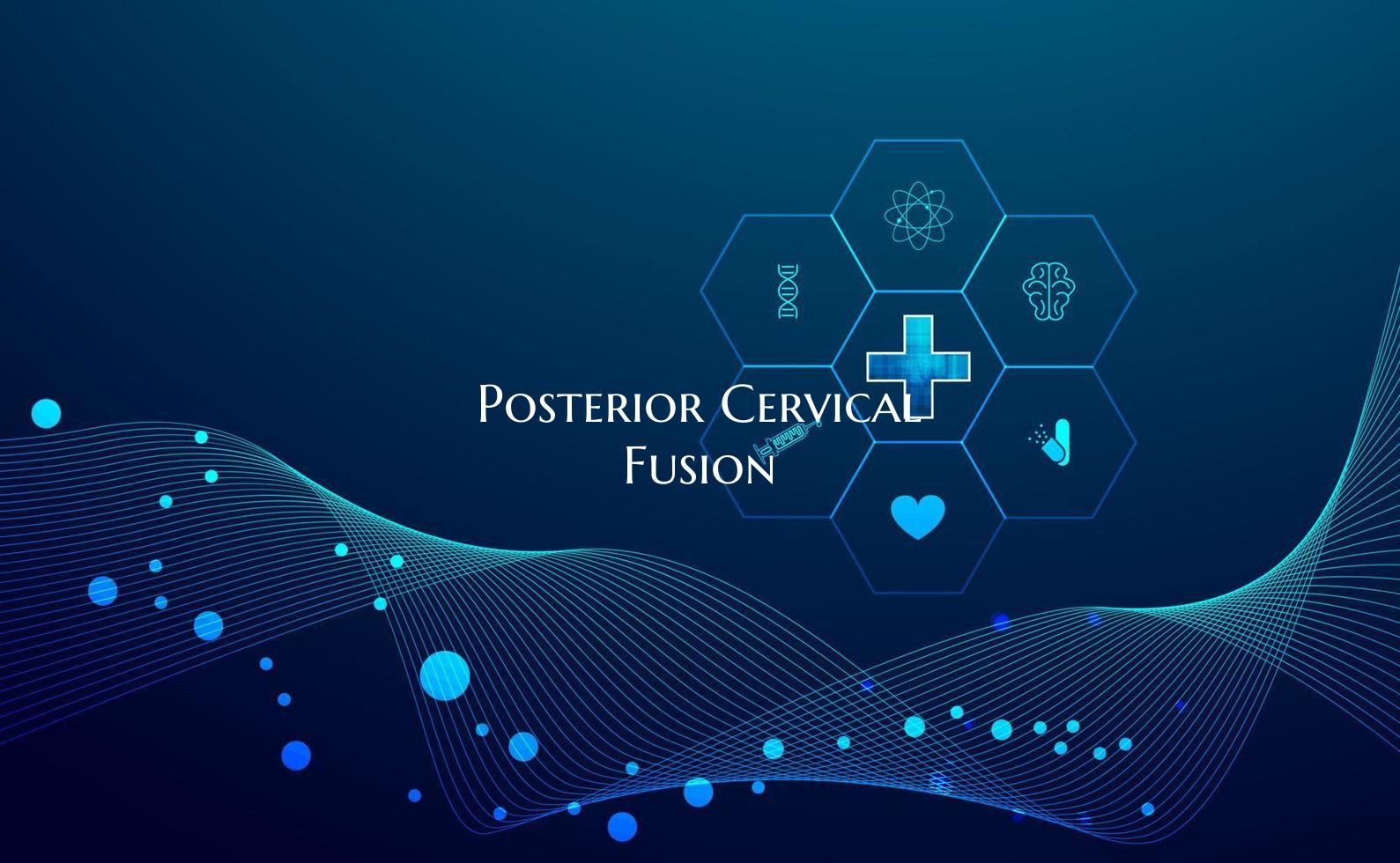 Posterior Cervical Fusion