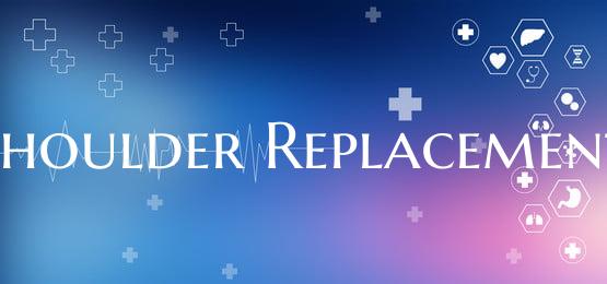 Shoulder Replacement