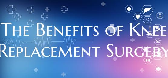 The Benefits of Knee Replacement Surgery